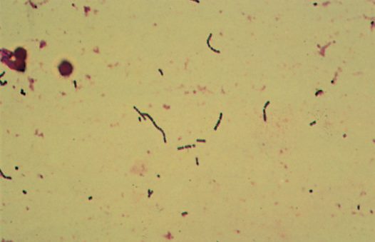 Streptococci seen on microscopy of surgical pus