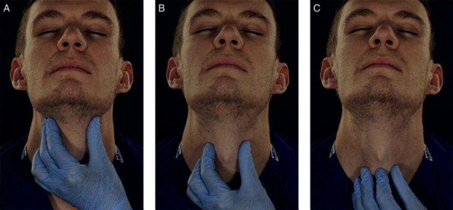 The laryngeal handshake, as described in the Difficult Airway Society 2015 guidelines