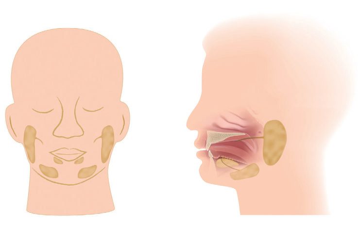 Anatomical position of the three major salivary glands