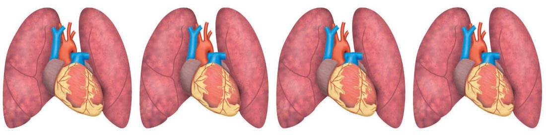 Types of lung transplant