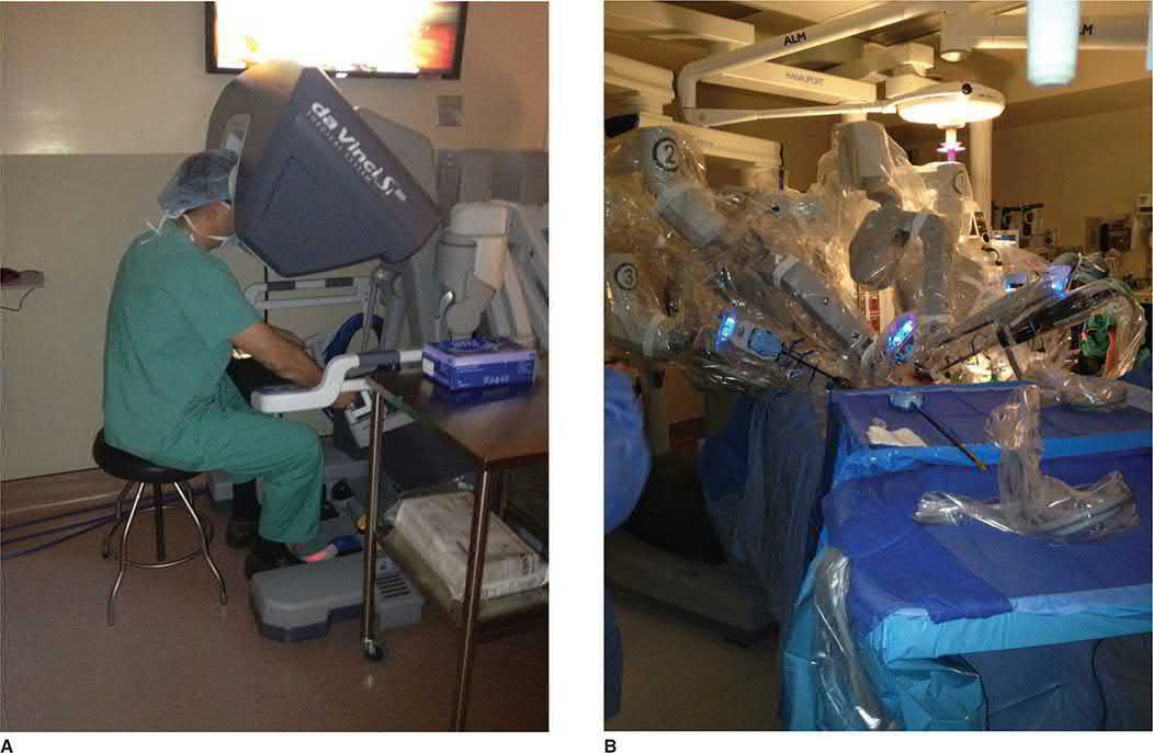 A. Surgeon seated at the console in control of the da Vinci robotic surgical system. B. Multi-arm robotic system docked and in use