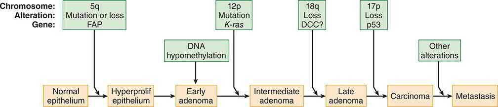Genetic model for colorectal tumorigenesis (adenoma-carcinoma sequence), showing sequential APC, K-ras, DCC and p53 alterations