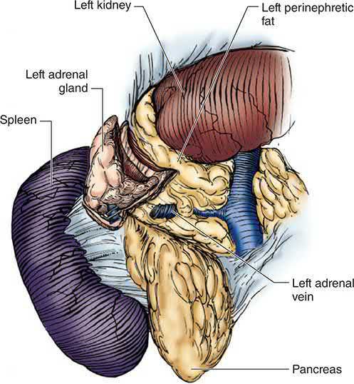Operative view during left laparoscopic adrenalectomy showing the left adrenal gland and adrenal vein with the spleen, pancreas and left kidney