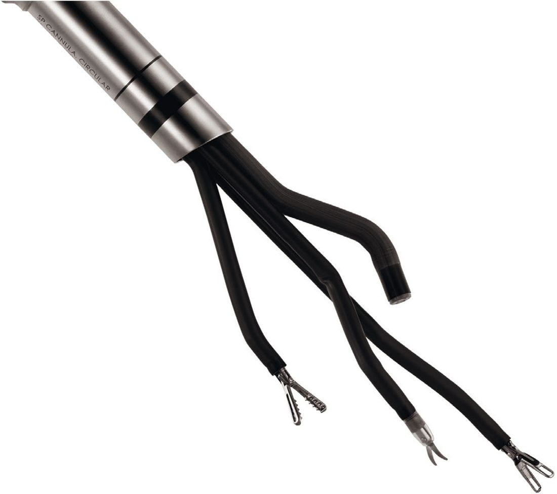 The da Vinci SP single-port technology, delivering one camera and three instruments through a single channel with wristed and elbowed movements
