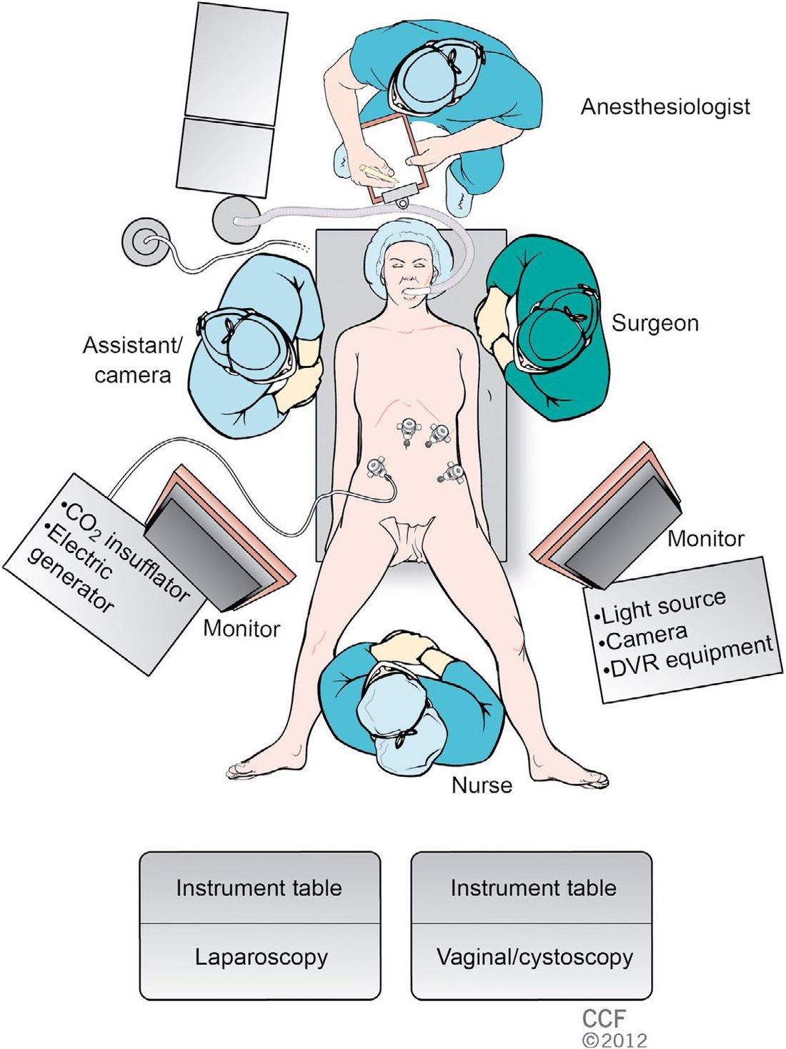 Operating room setup for operative laparoscopy, showing team positions, monitors, the CO2 insufflator and electric generator, and the light source and camera equipment