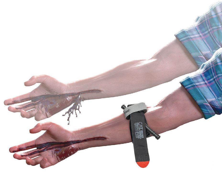 Bleeding control kit containing a tourniquet, plain and haemostatic gauze, and gloves