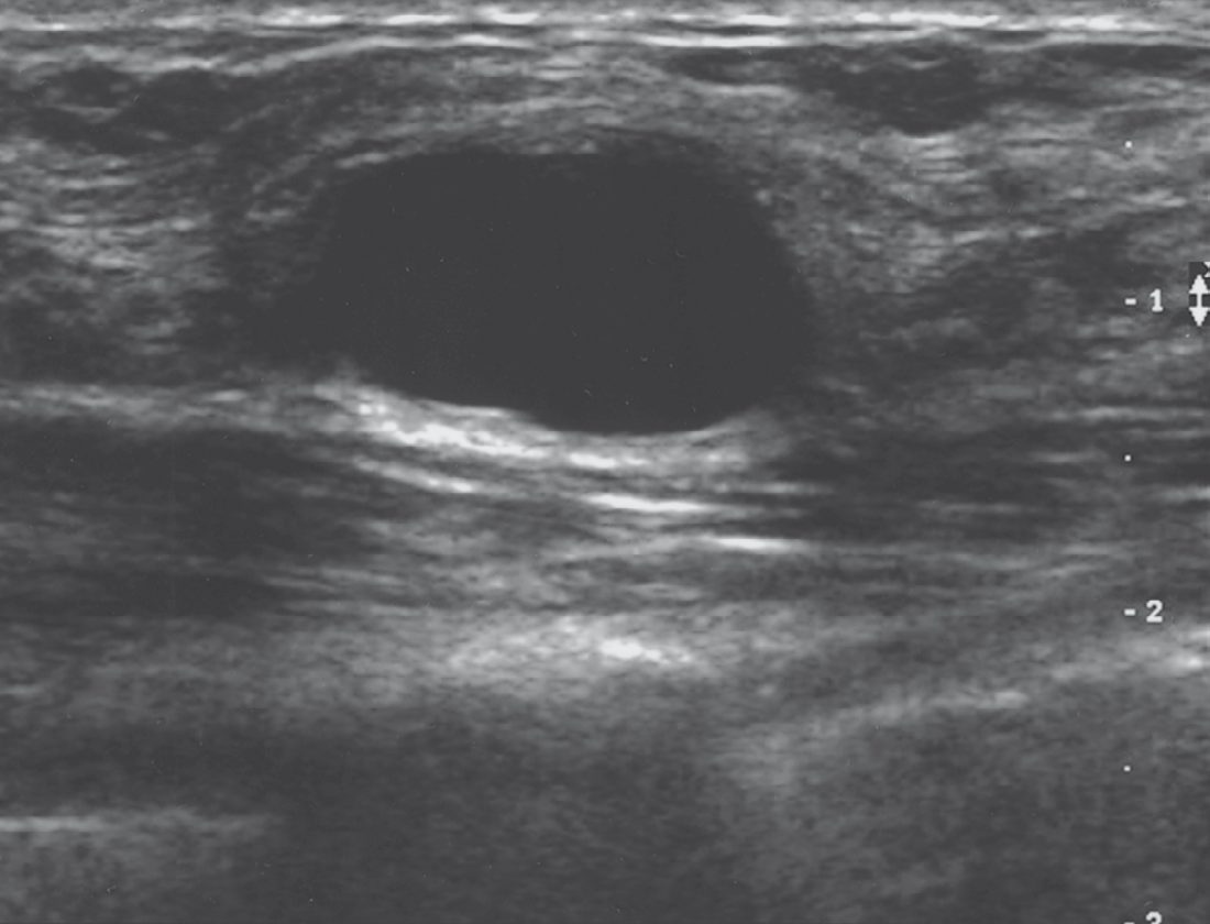 Mammography, ultrasound and magnetic resonance imaging findings in breast disease