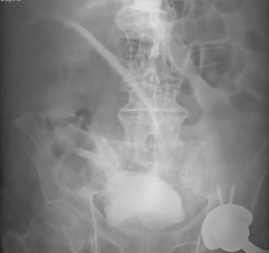 Plain film radiographs of acute abdominal pathologies