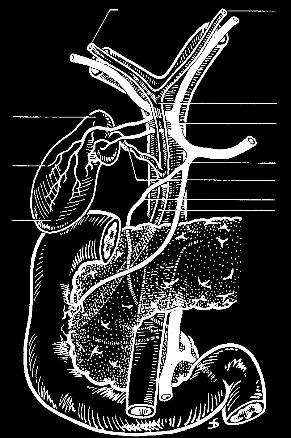 Extrahepatic biliary anatomy