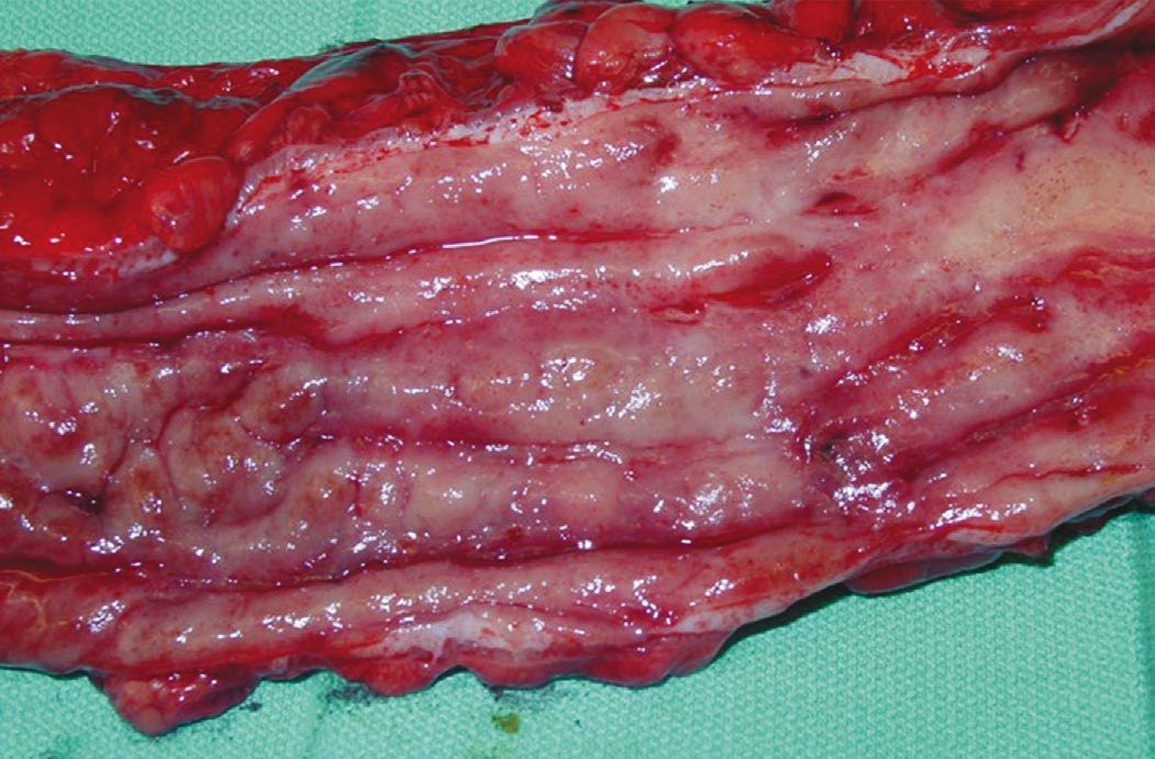 Macroscopic view of longitudinal