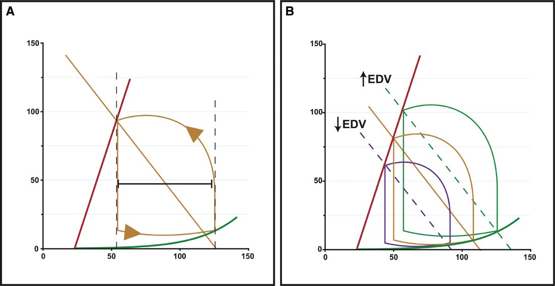 Left ventricular pressure-volume loops: a standard loop (A) and the effect of increased and decreased end-diastolic volume, i.e. preload, on stroke volume (B)